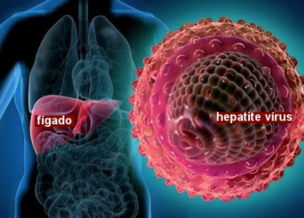 Muitas pessoas são portadoras dos vírus de hepatites tipos B e C, mas não sabem